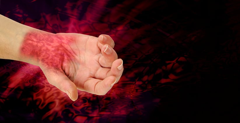 Wrist and hand palm face up showing painful looking nasty redness across wrist area symbolizing the pain of RSI on a black and angry red wide background representing pain