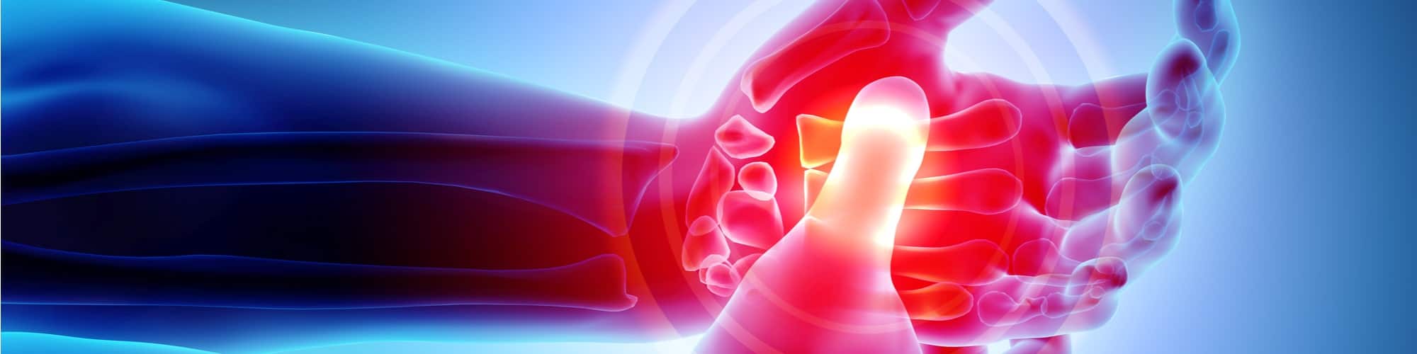 Arthritis and Bursitis Treatments | OrthoUnited