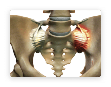 si-joint-diagnosis