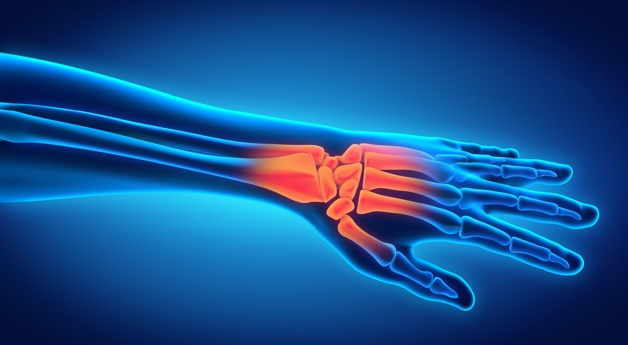 Wrist pain